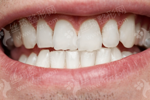 朝陽(yáng)做隆胸醫(yī)院排行榜醫(yī)院優(yōu)勢(shì)-醫(yī)院簡(jiǎn)介!醫(yī)院優(yōu)勢(shì)