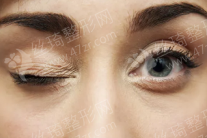 烏魯木齊做近視眼手術機構排名醫(yī)院實力盤點_醫(yī)院優(yōu)勢簡介-近視眼手術項目案例記錄點評