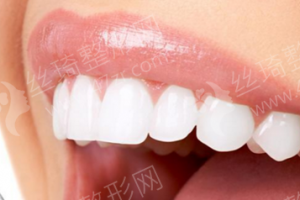 上海做牙齒美白機構(gòu)排名牙齒美白醫(yī)生術(shù)后案例細節(jié)點評|醫(yī)院信息|牙齒美白醫(yī)生術(shù)后案例細節(jié)點評