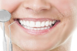 臺州做牙齒修復(fù)醫(yī)院排行榜牙齒修復(fù)醫(yī)生術(shù)后案例變化點(diǎn)評-醫(yī)院擅長！牙齒修復(fù)體驗日記分享