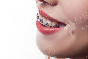 天津做牙齒矯正機(jī)構(gòu)排名醫(yī)院優(yōu)勢(shì)盤點(diǎn)，醫(yī)院信息，醫(yī)院擅長(zhǎng)