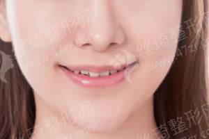 北京做牙齒清潔醫(yī)院排行榜醫(yī)院優(yōu)勢介紹|牙齒清潔案例記錄分享,牙齒清潔醫(yī)生術(shù)后案例日記評價(jià)